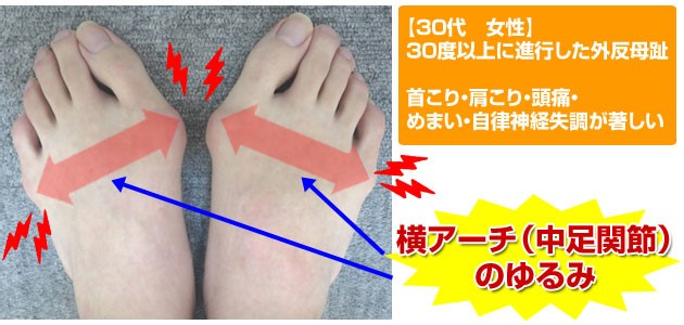 外反母趾の改善率91 9 姫路市飾磨区の新井接骨院は メディア実積も豊富な地元で人気の老店です